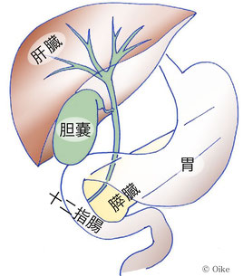 胆石の症状