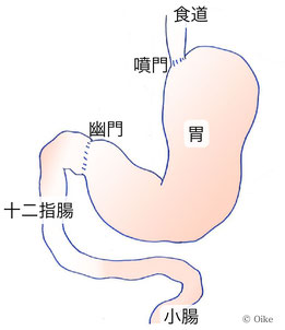 胃癌ができる場所